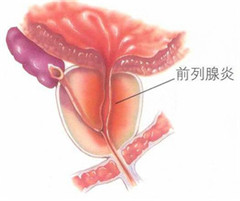 阳江男科医院