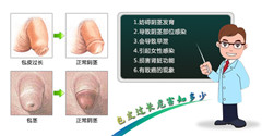 <a class='link_keywords' href='http://www.yjrj120.com/'>阳江仁济医院</a>