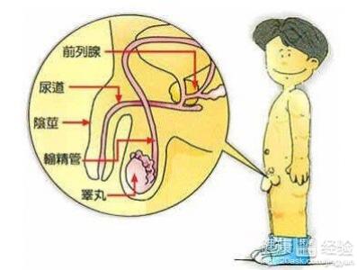 治疗附睾炎