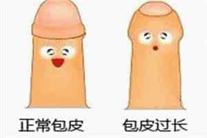 包茎手术是个什么样的情况?