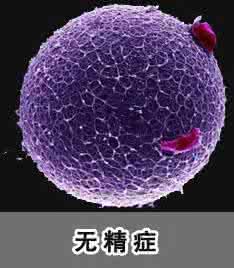 无精症的常见误区有多少?