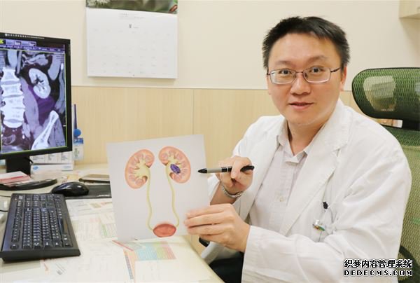 亚洲大学隶属医院震波碎石室主任石欣卫暗示，肾盂泌尿道上皮癌等于泌尿道上皮细胞癌化所导致。（图片／亚洲大学隶属医院提供）